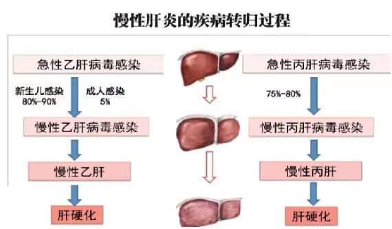 【健康科普】世界肝炎日——堅持早預防，加強檢測發(fā)現(xiàn)，規(guī)范抗病毒治療
